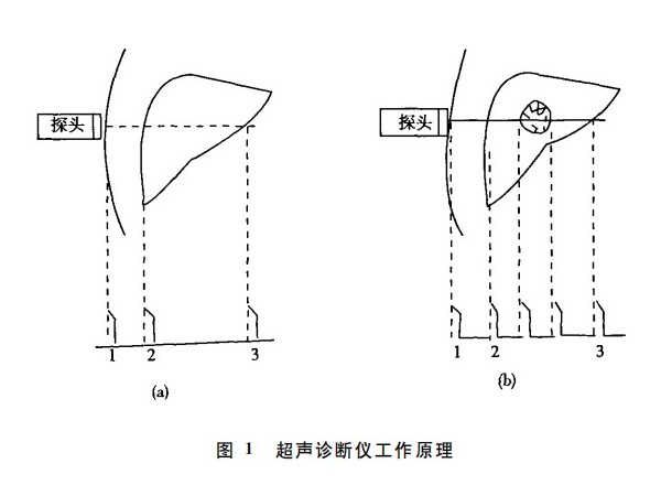超声波探测技术在医学中的应用（二）