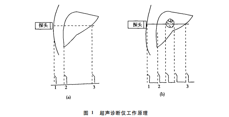 超声波诊断仪工作原理